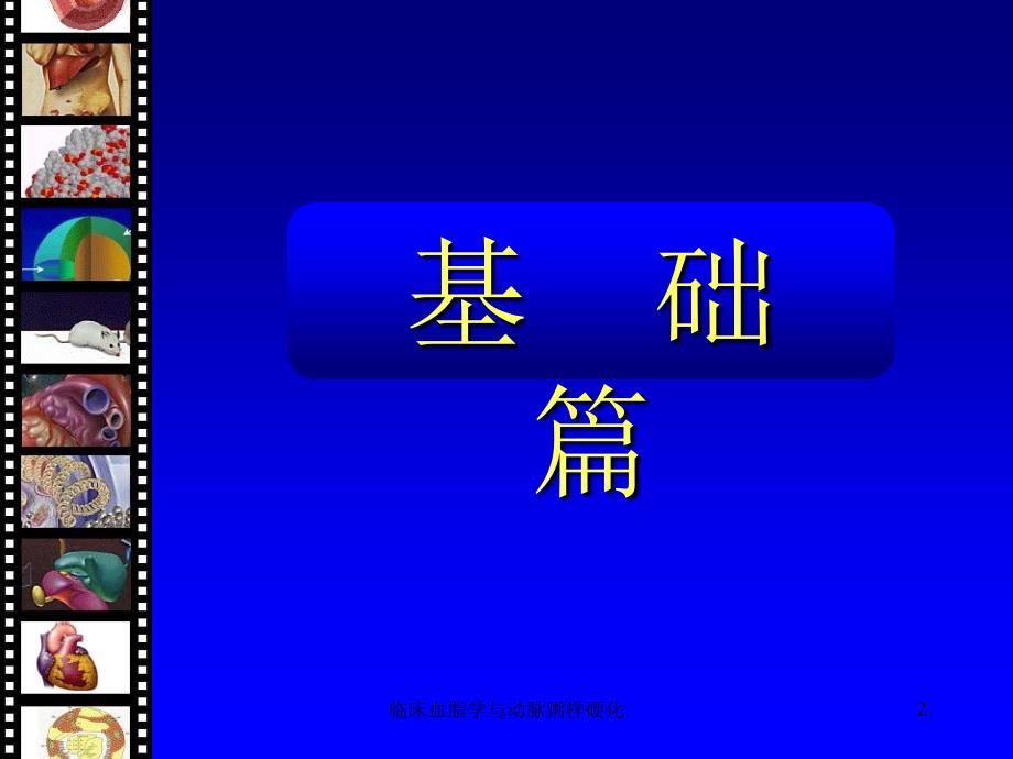 临床血脂学与动脉粥样硬化课件_第2页