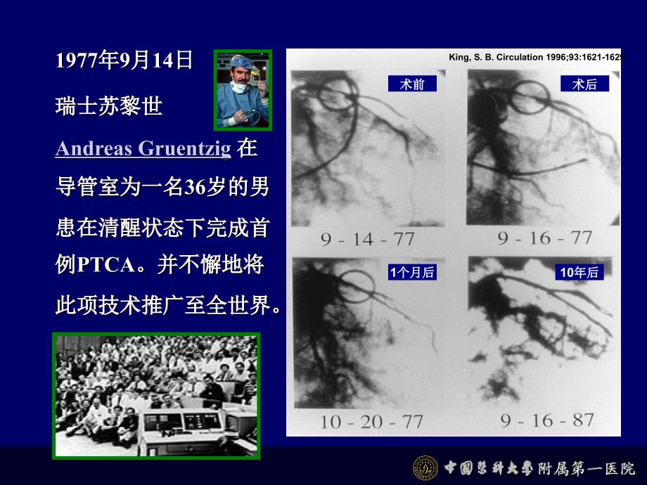 冠心病介入治疗时机的选择ppt课件_第4页