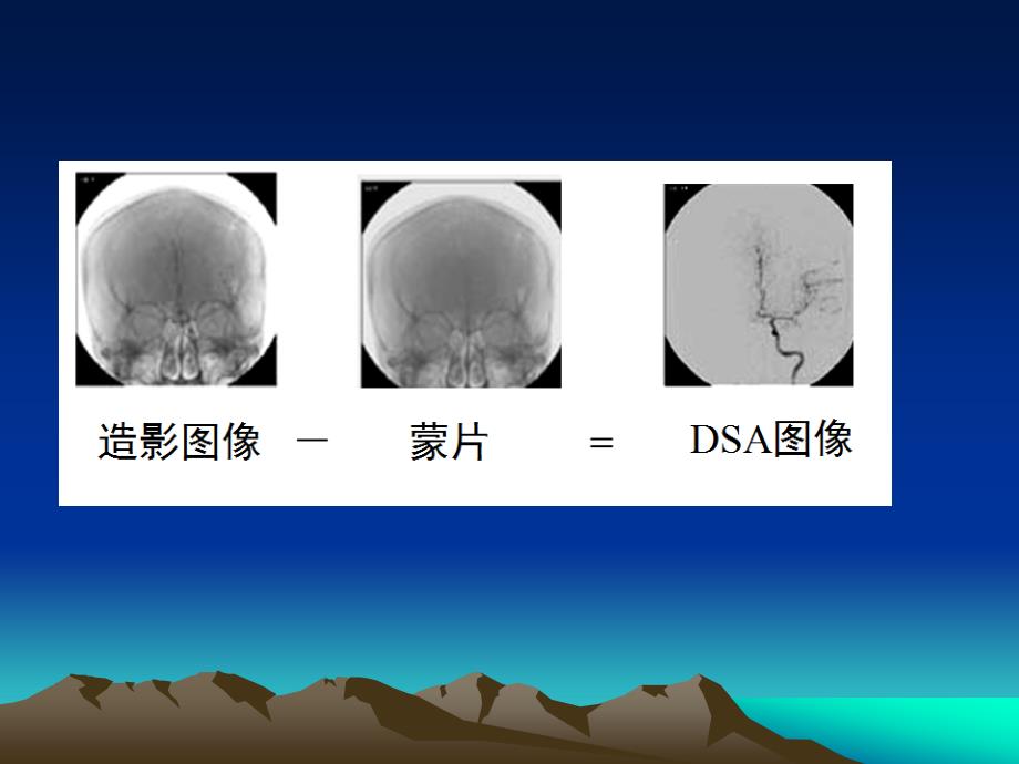 DSA设备及成像原理_第4页