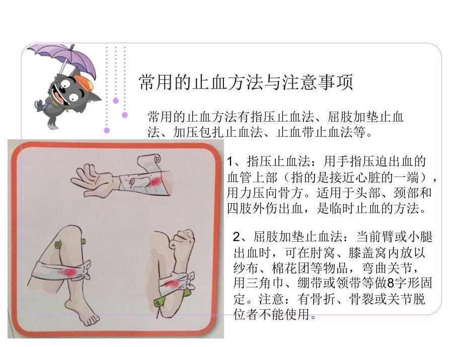 医学专题：现场四项急救常识.ppt_第5页