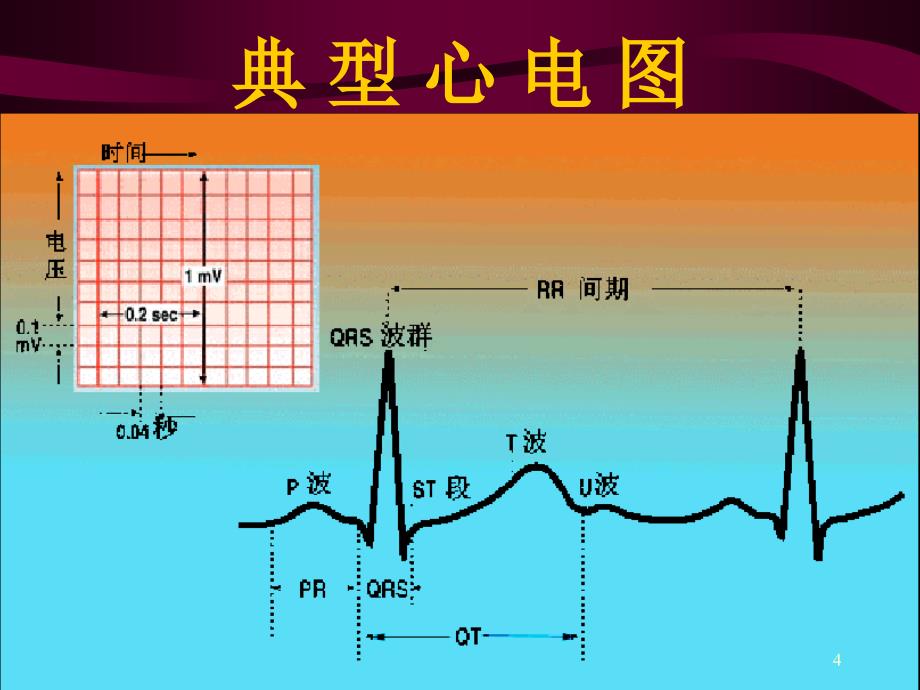 心电图优秀课件_第4页