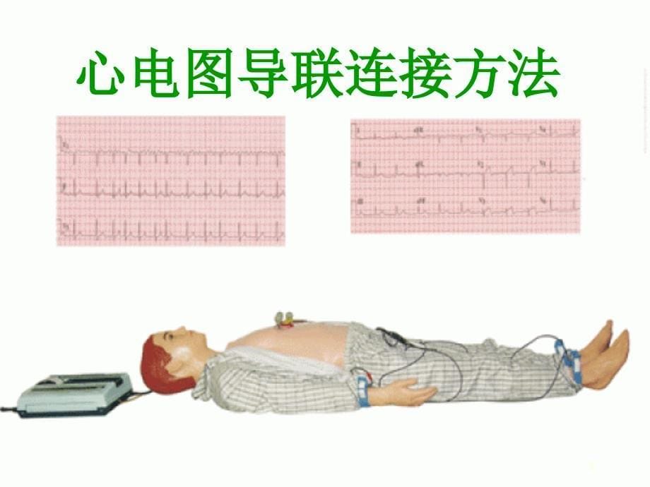 心电图优秀课件_第5页