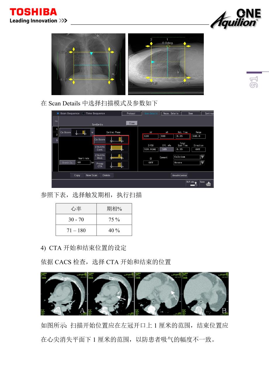 东芝320CT操作手册---8.320CT-心脏CT检查_第3页