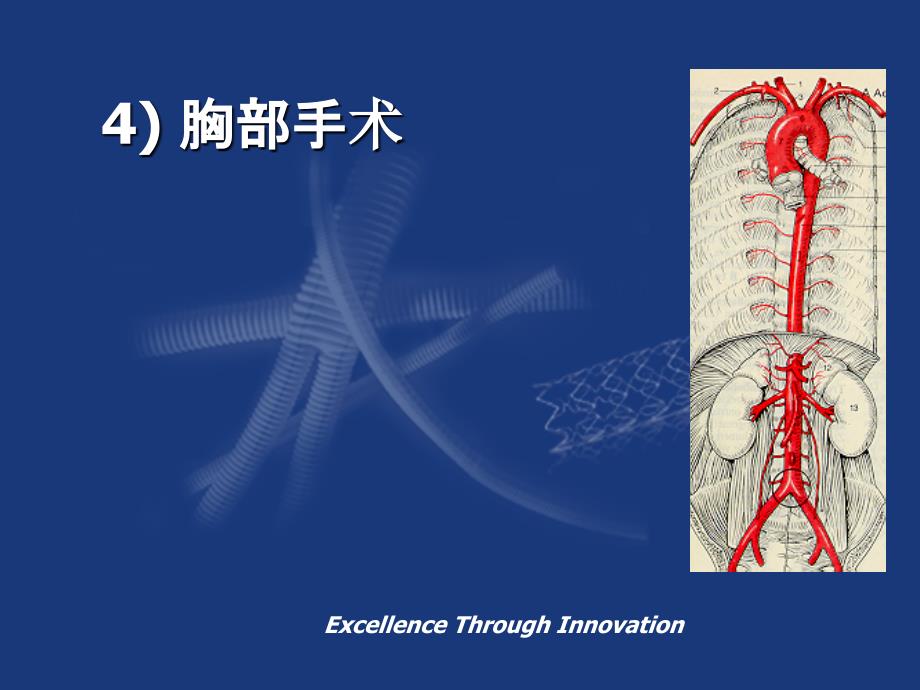 阜外大血管胸主动脉手术_第1页