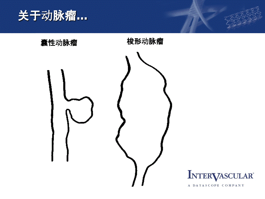 阜外大血管胸主动脉手术_第4页