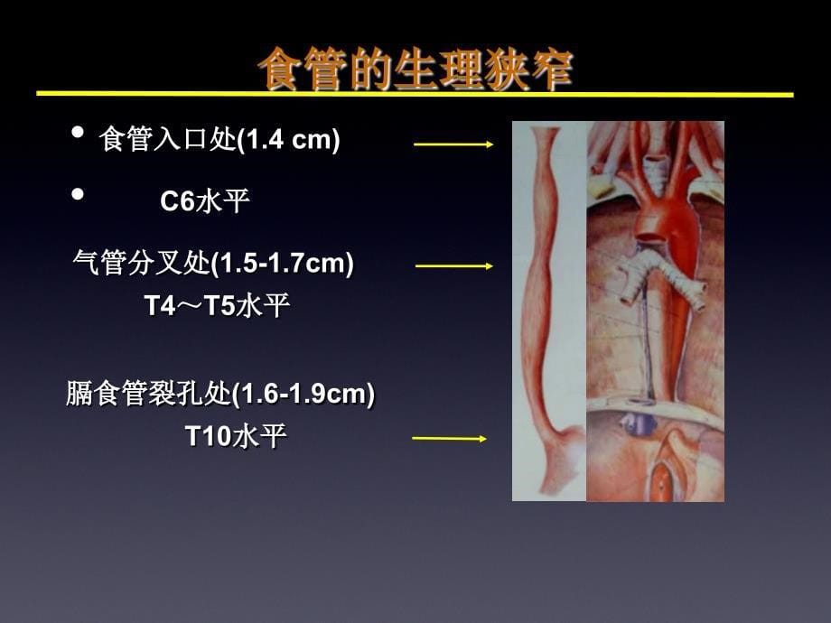 外科学教学课件：食管癌(英文班）_第5页