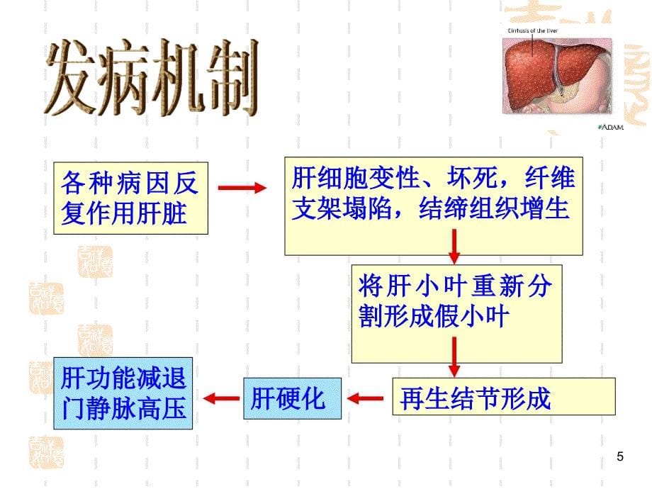 肝硬化病人的护理查房 ppt课件_第5页