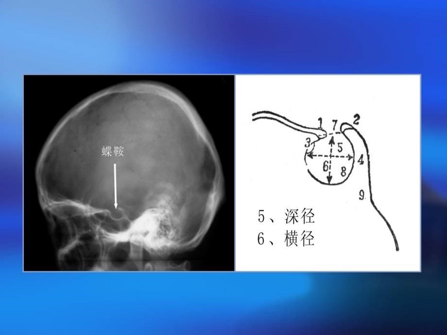 影像学中枢神经系统1_第5页