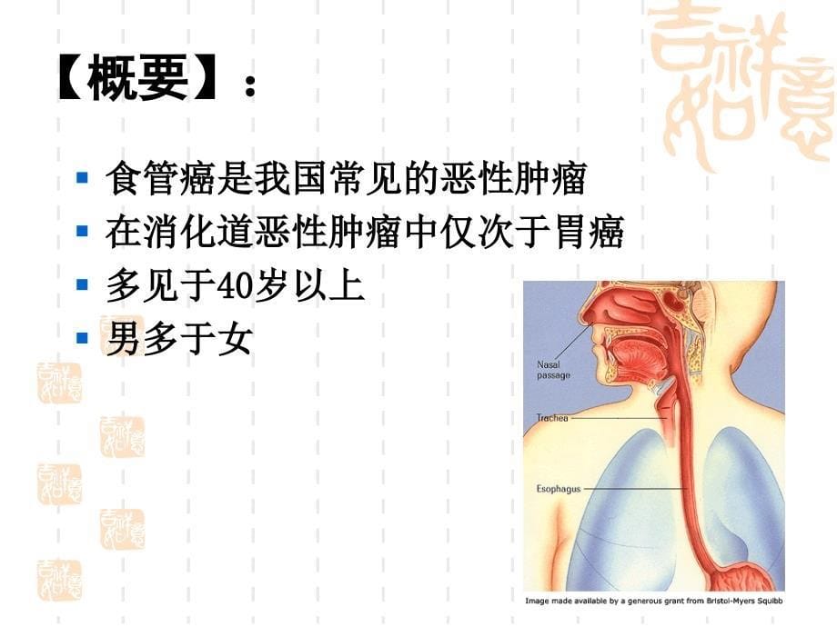 食管癌患者的护理_第5页