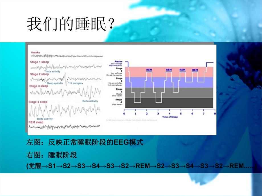 护考辅导睡眠障碍.ppt_第2页