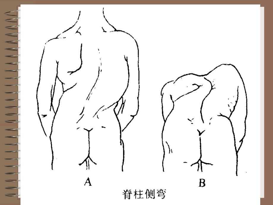 脊柱及四肢体格检查ppt课件_第4页