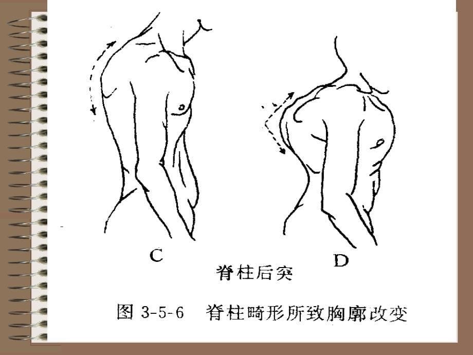 脊柱及四肢体格检查ppt课件_第5页