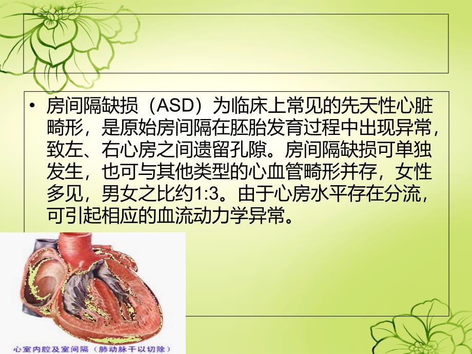 房间隔缺损护理查房.ppt_第2页