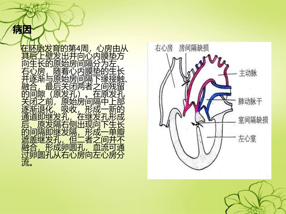 房间隔缺损护理查房.ppt_第4页