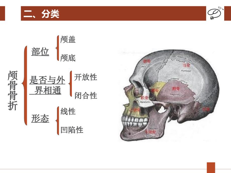 颅骨骨折03版ppt课件_第4页