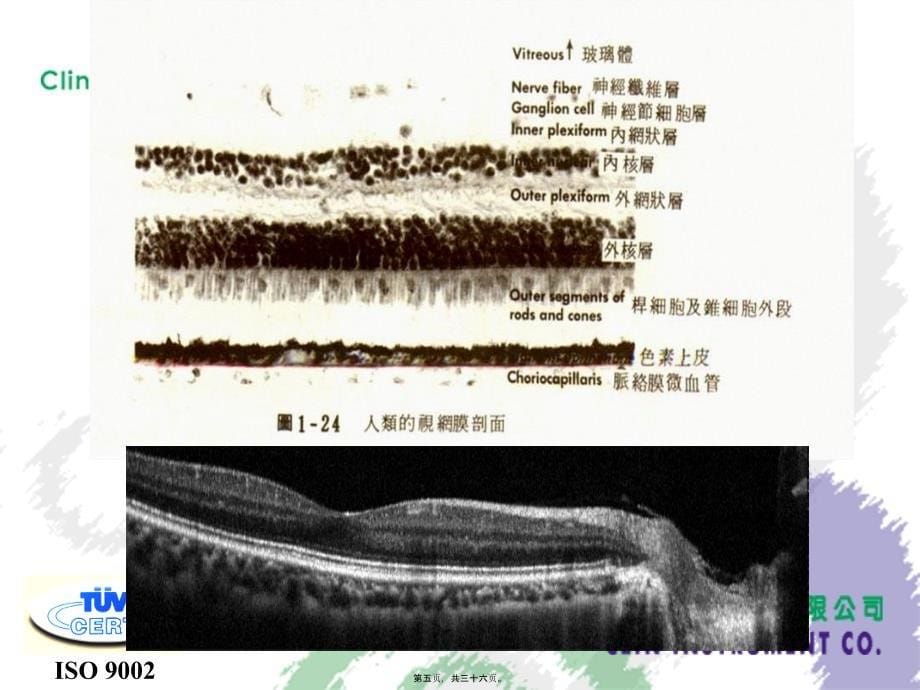 医学专题—眼底造影基础_第5页