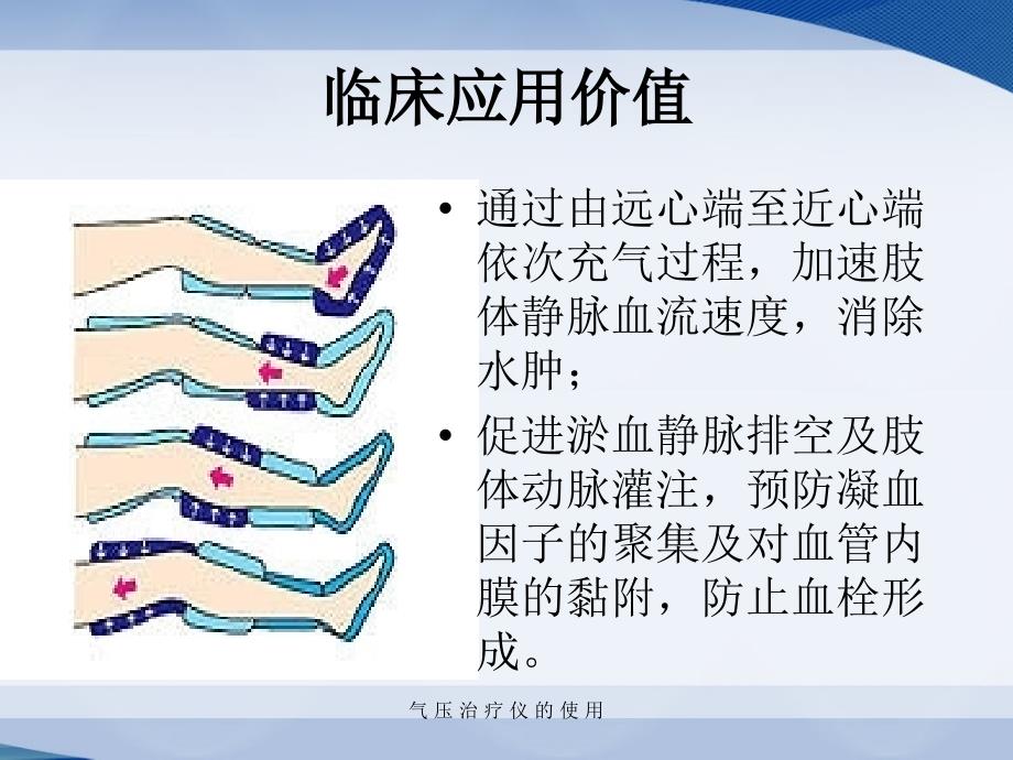 最新气压治疗仪的使用_第2页