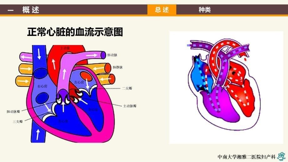 妊娠合并心脏病yld_第5页