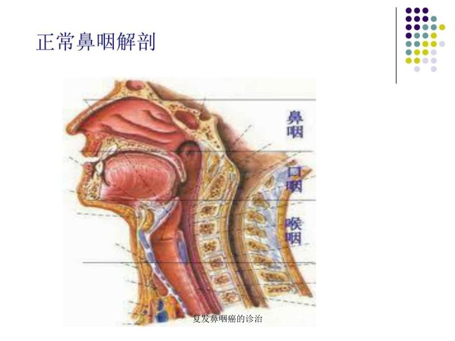 复鼻咽癌的诊治课件_第2页