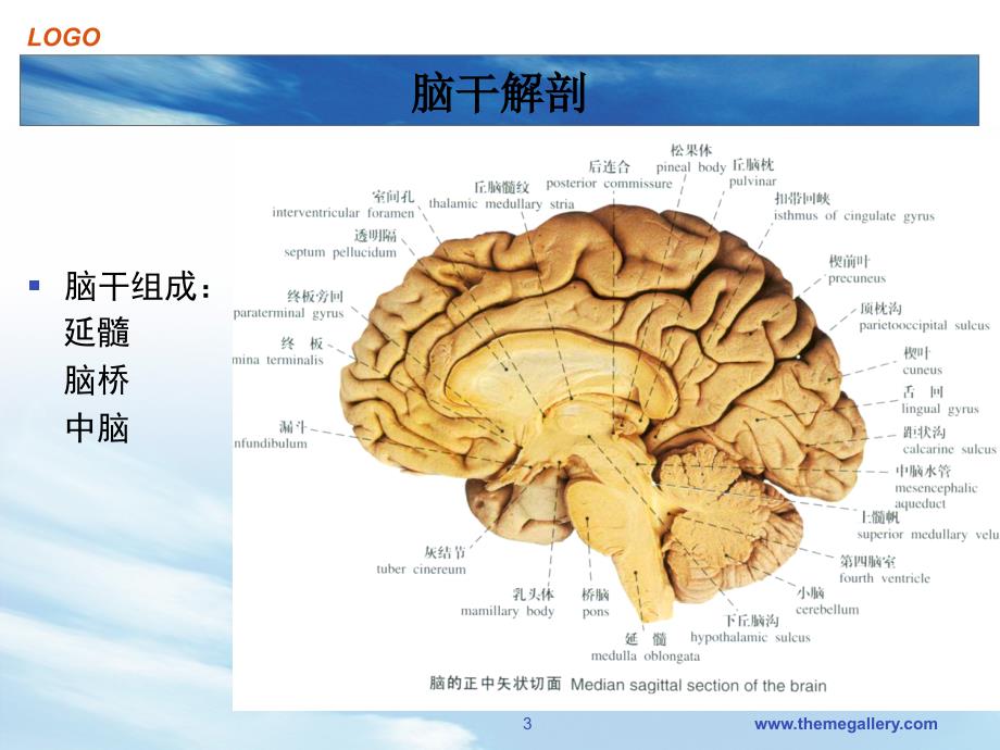 脑干出血PPT演示课件_第3页