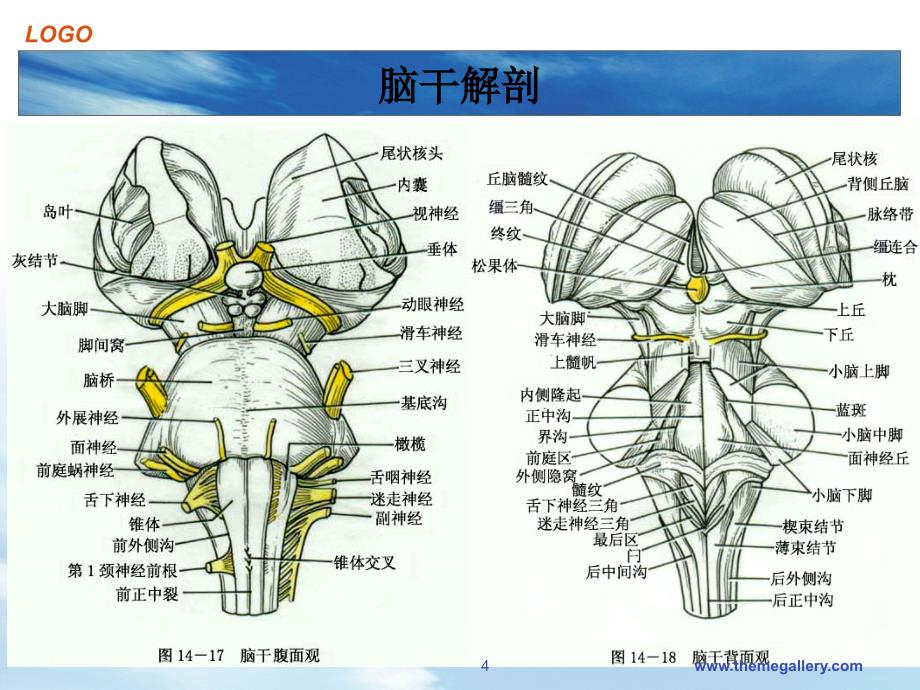 脑干出血PPT演示课件_第4页