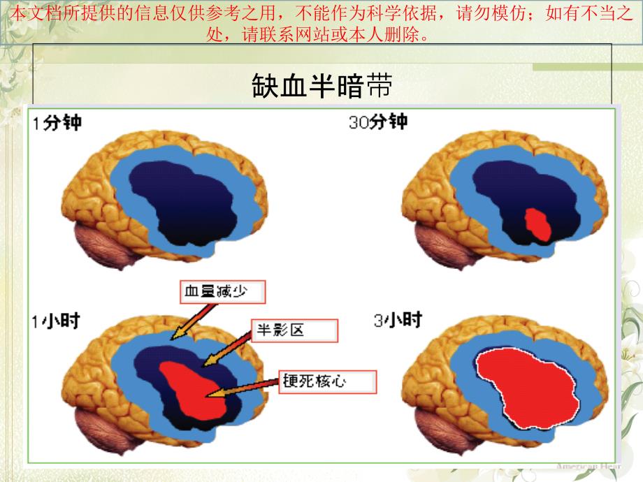 急性脑梗死静脉溶栓培训课件_第1页