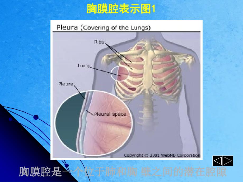 胸腔积液教案ppt课件_第3页