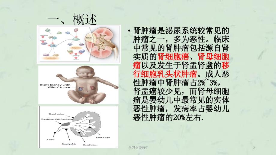 肾癌护理查房课件_第2页