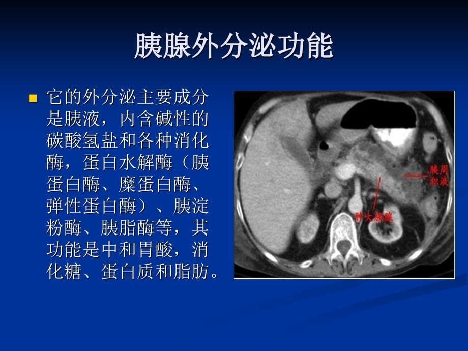 高脂血症性胰腺炎图文_第5页