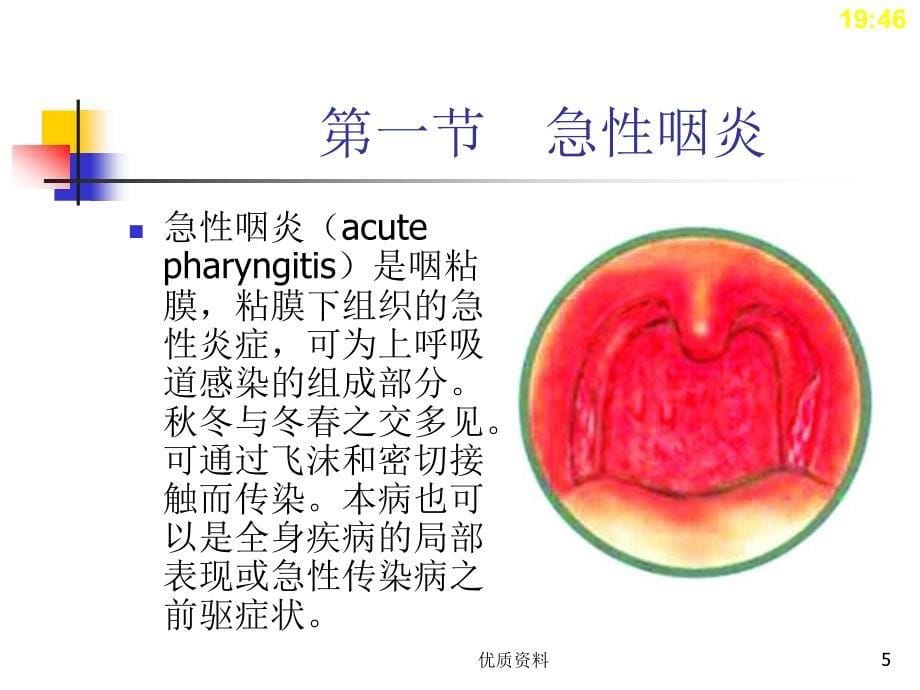 耳鼻喉科常见疾病..【优质档案】_第5页