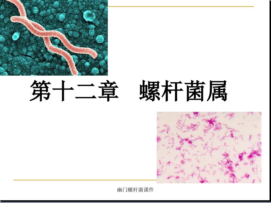 幽门螺杆菌课件_第1页