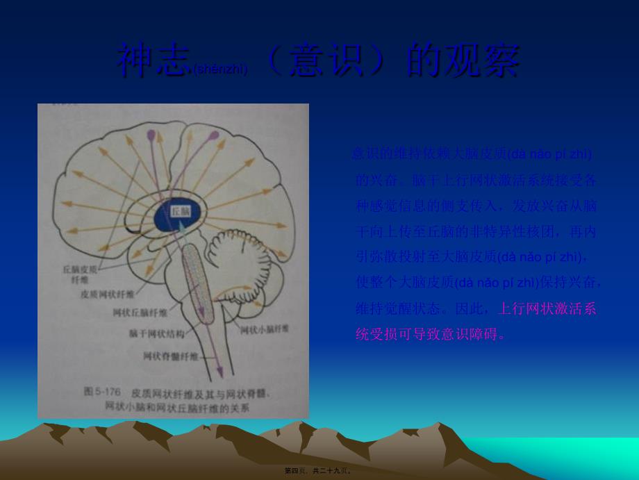 医学专题—神志意识的观察(讲-座)--长沙市第四医院神经外科何承彪_第4页