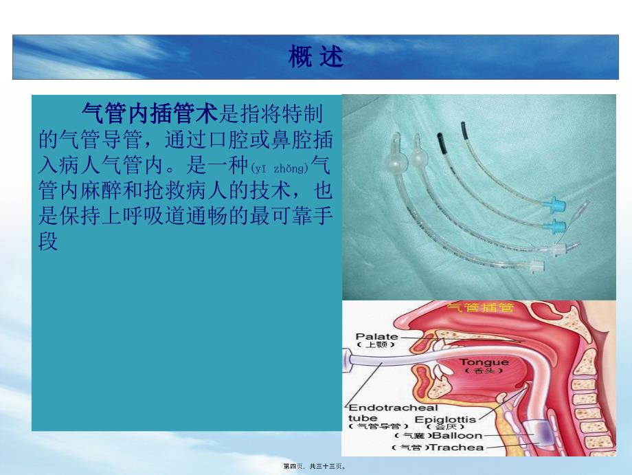 气管插管胡红梅课件_第4页