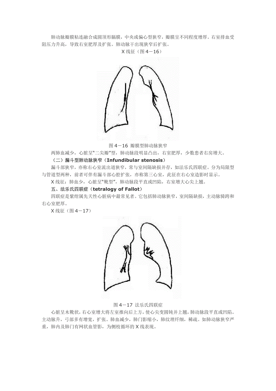 常见先心病的X线表现.doc_第3页