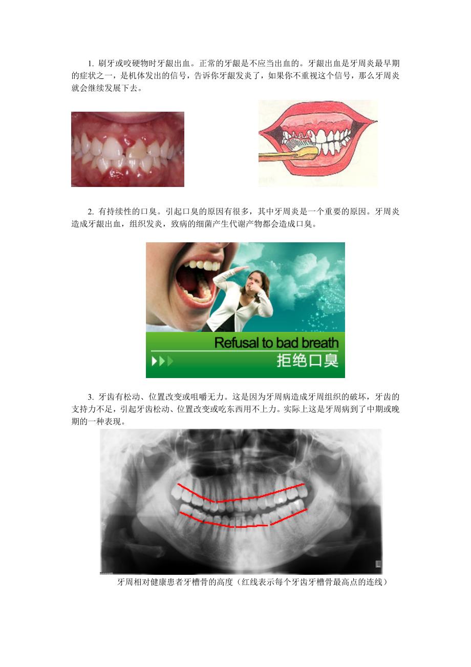 牙周宣传册.jsp.doc_第3页
