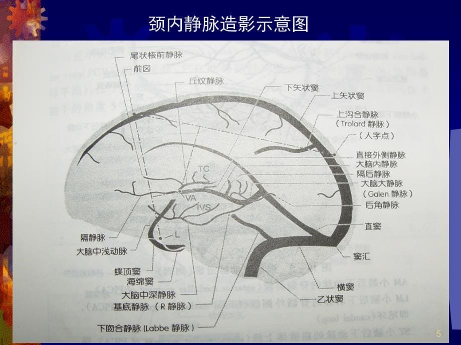 静脉窦血栓MR诊断_第5页