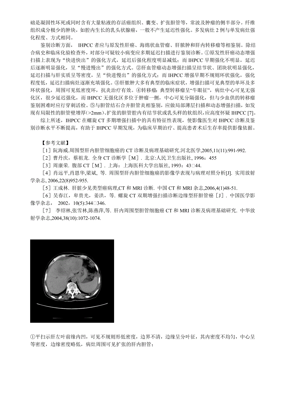 螺旋CT多期增强扫描在肝内周围型胆管细胞癌诊断中的应用价值.doc_第3页