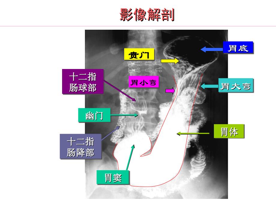 医学影像诊断学：胃十二指肠_第3页