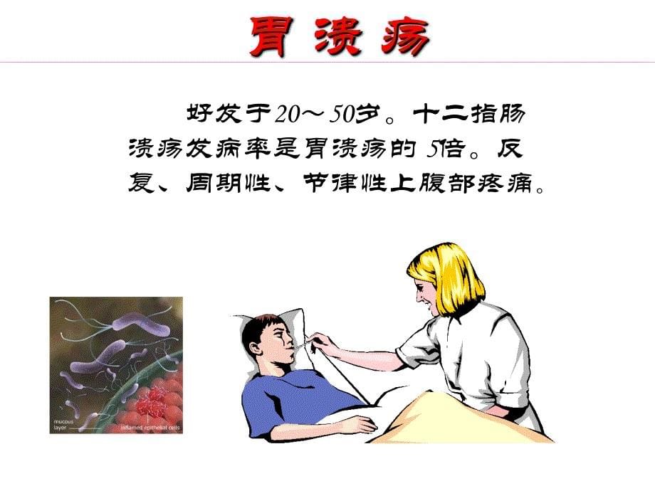 医学影像诊断学：胃十二指肠_第5页