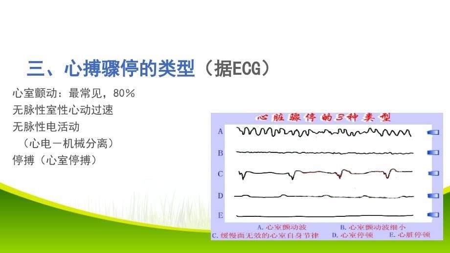 心肺复苏PPT课件2_第5页