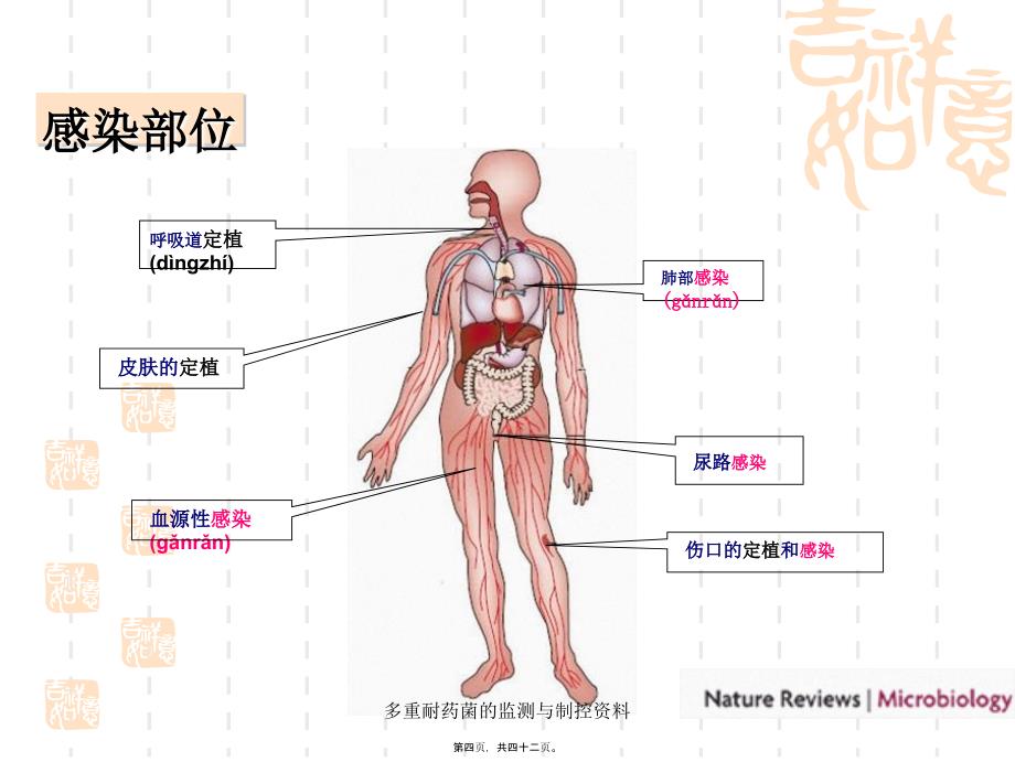 多重耐药菌的监测与制控资料课件_第4页