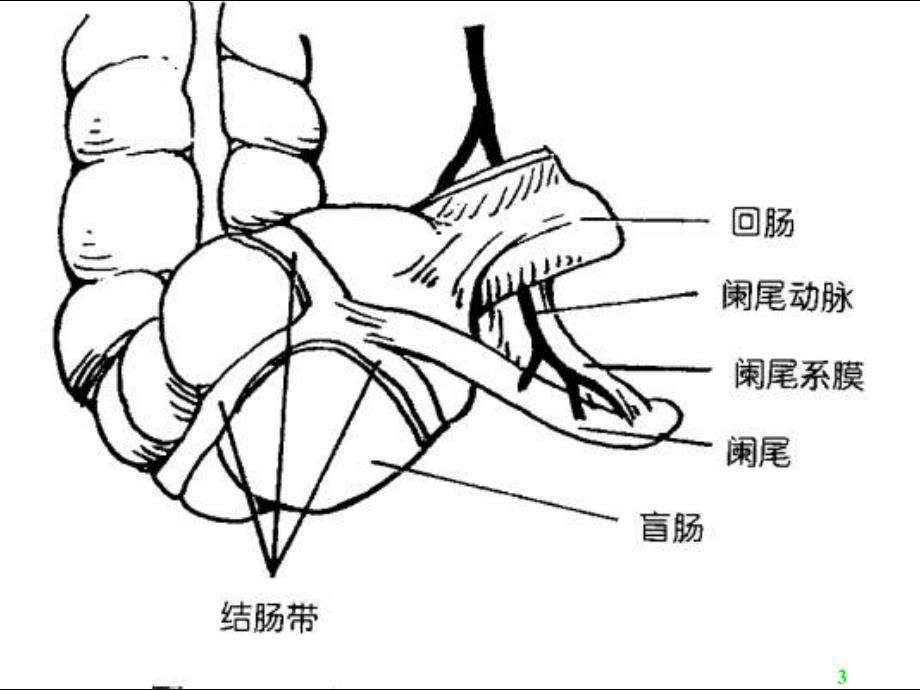 阑尾炎Acutea_第3页