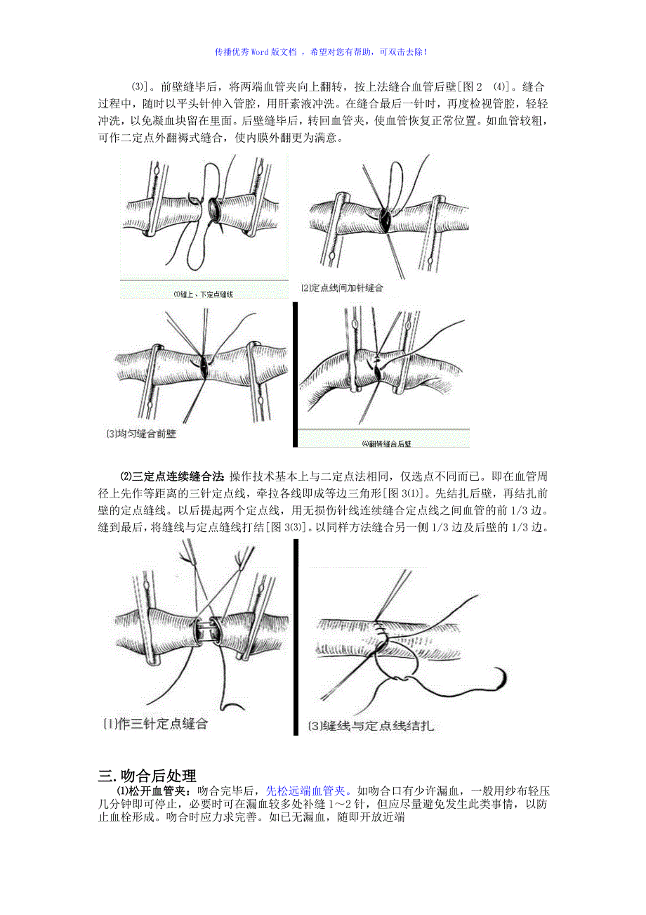 血管吻合技术Word编辑_第2页