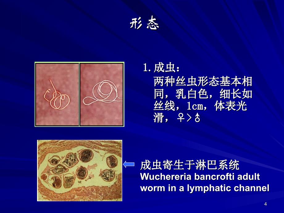 人体寄生虫学丝虫_第4页