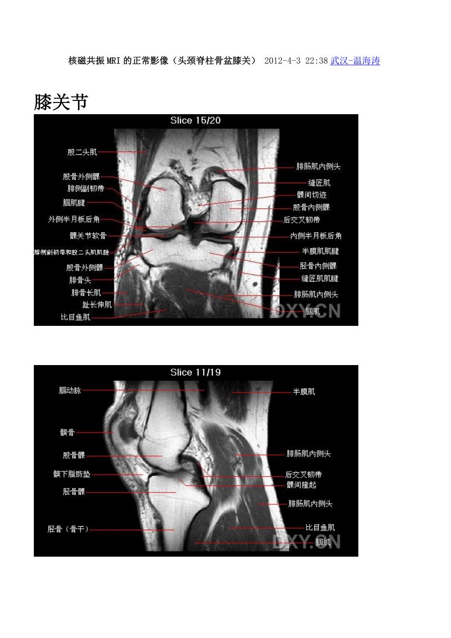 核磁共振MRI的正常影像-头颈脊柱膝关节.doc_第1页