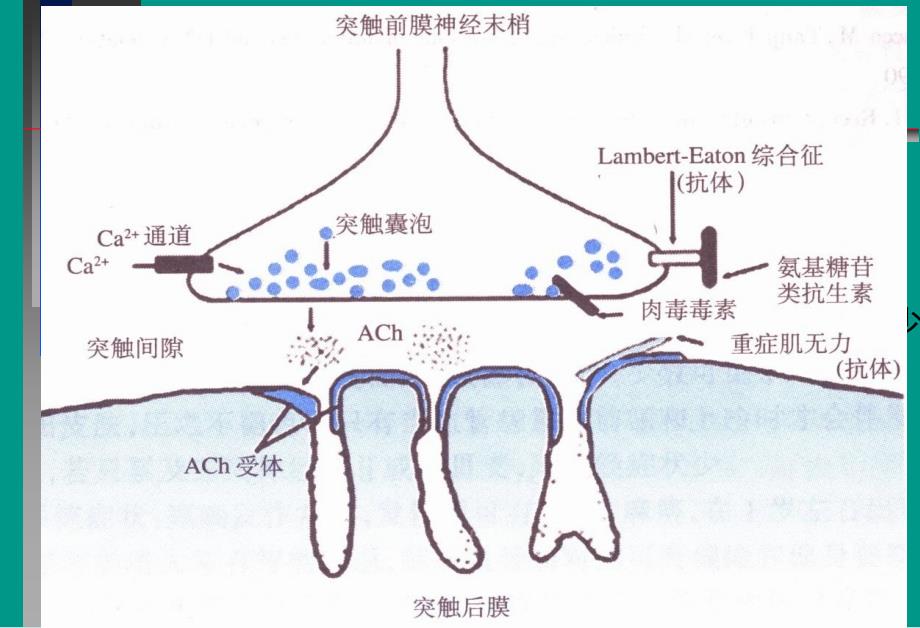 神经病学教学课件重症肌无力中文_第3页