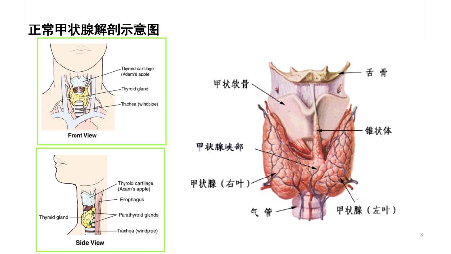 甲状腺毒症的诊治PPT课件_第3页