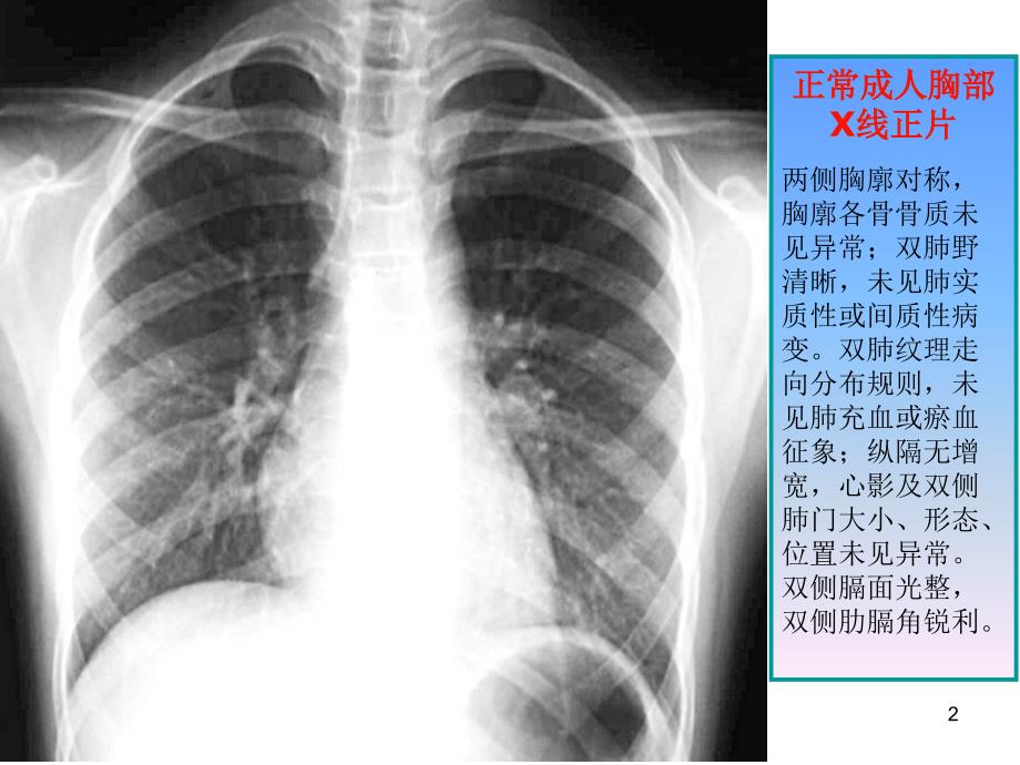 执业医师技能考试X线诊断ppt课件.ppt_第2页