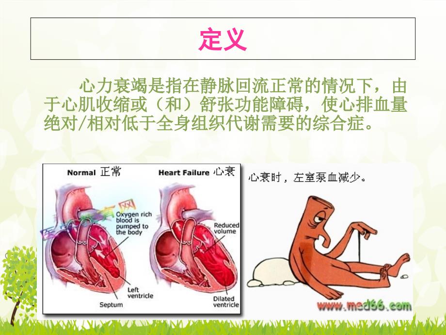 心力衰竭护理查房ppt课件_第3页