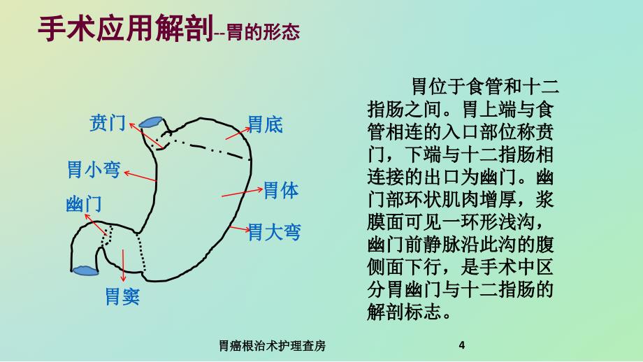 胃癌根治术护理查房课件_第4页